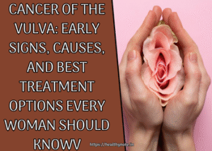 Cancer of the Vulva: Early Signs, Causes, and Best Treatment Options Every Woman Should Know