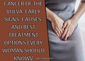 Cancer of the Vulva: Early Signs, Causes, and Best Treatment Options Every Woman Should Know
