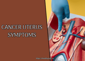Cancer Uterus Symptoms: What Every Woman Should Know