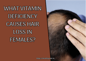 What Vitamin Deficiency Causes Hair Loss in Females?