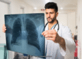 Lung Transplant Life Expectancy What You Need to Know to Prepare for the Future