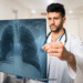 Lung Transplant Life Expectancy What You Need to Know to Prepare for the Future