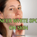 Cancer White Spots on Skin