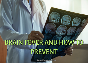 Brain fever and how to prevent