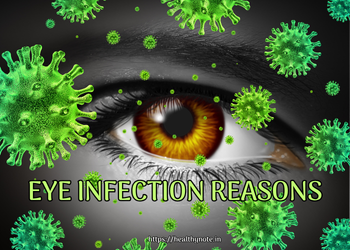 Eye Infection Reasons