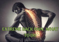 Extreme Back pain, what to do